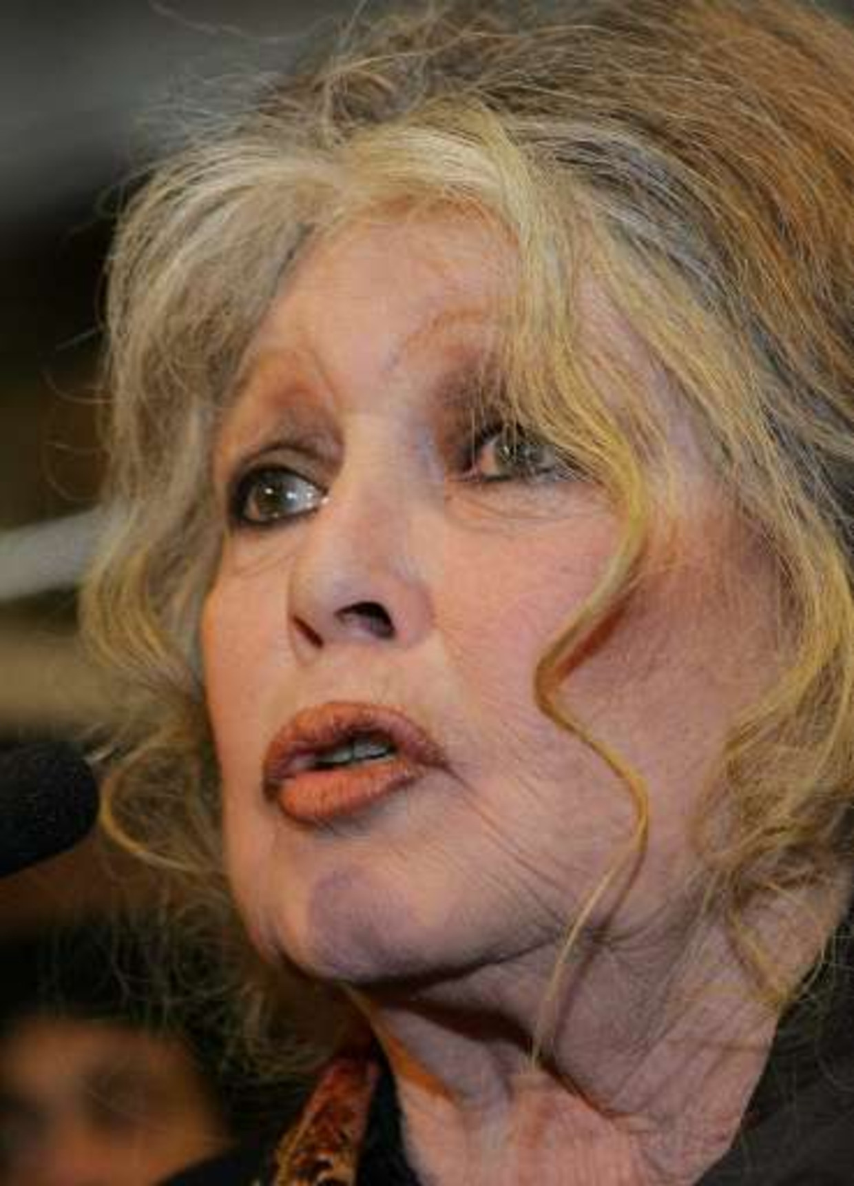 brigitte-bardot-racisme-hotsell-emergencydentistry